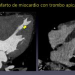 Diapositiva10