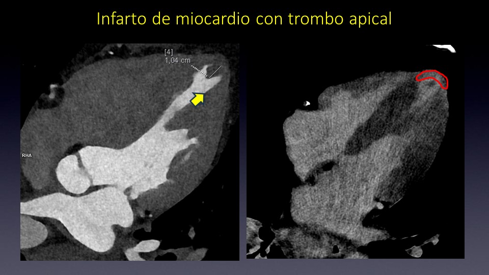 Diapositiva10