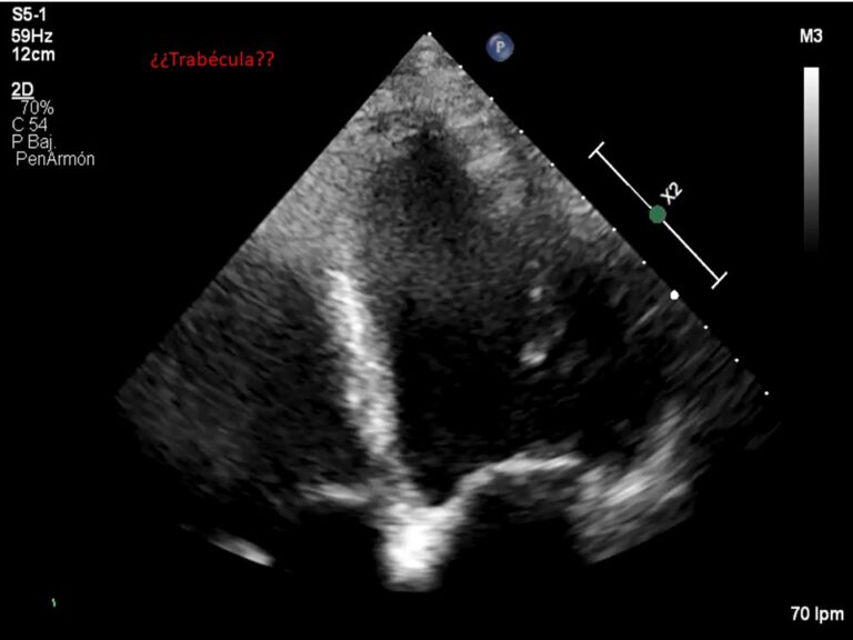 Diapositiva10