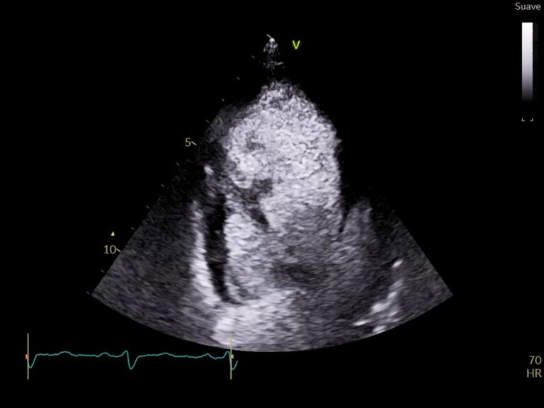 Diapositiva11