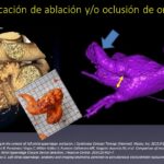 Diapositiva12