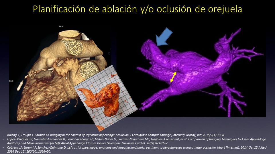 Diapositiva12