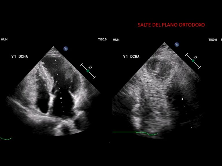 Diapositiva12