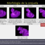 Diapositiva13