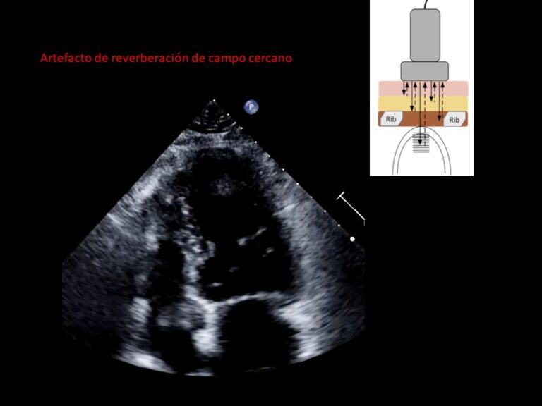 Diapositiva13