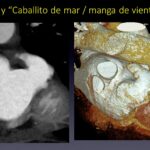 Diapositiva14