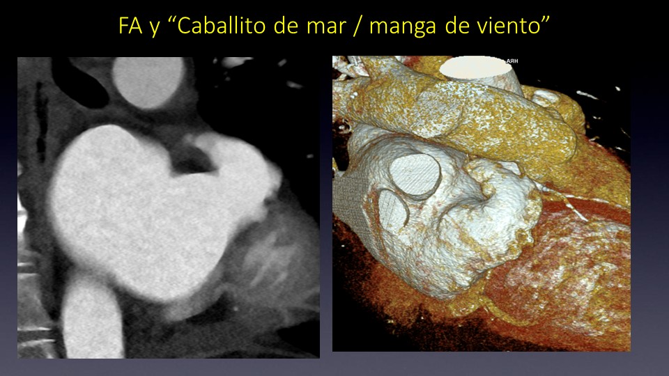 Diapositiva14
