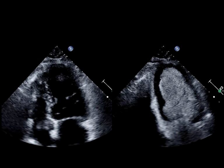 Diapositiva14