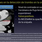 Diapositiva15