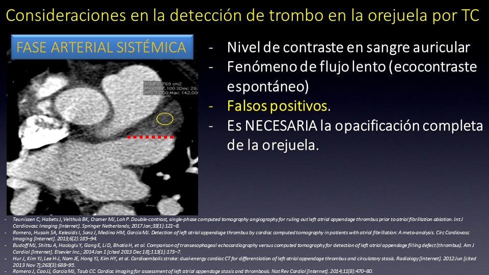 Diapositiva15