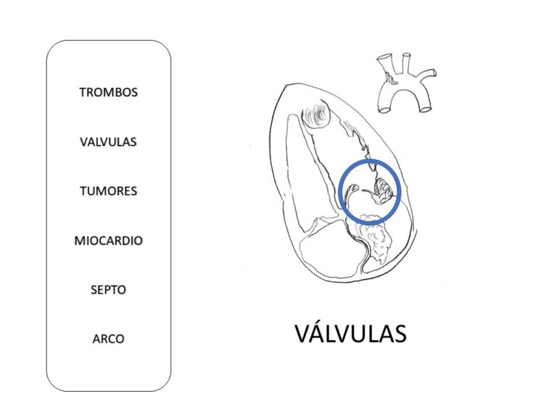 Diapositiva15