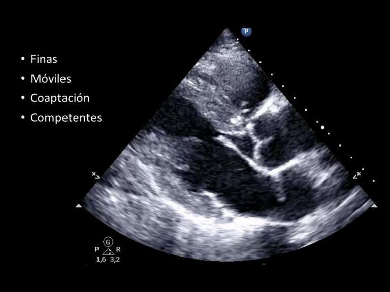 Diapositiva16