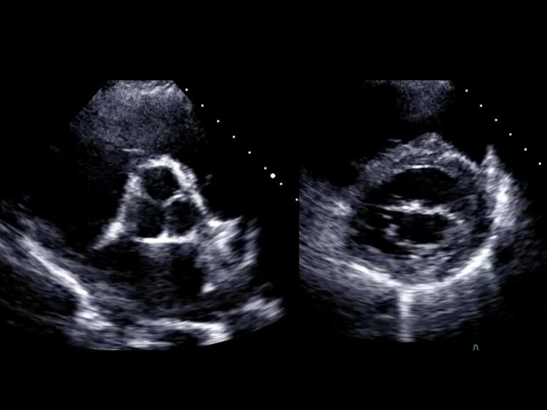 Diapositiva17
