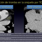 Diapositiva18