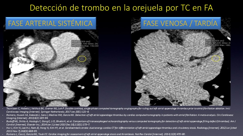 Diapositiva18