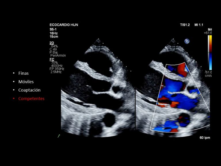 Diapositiva18