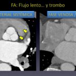 Diapositiva19
