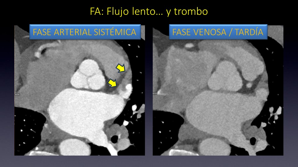 Diapositiva19