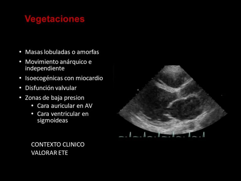 Diapositiva19