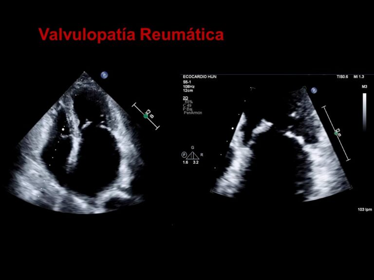 Diapositiva21