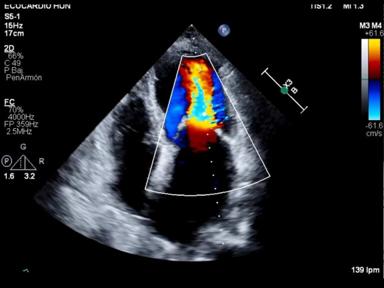 Diapositiva22