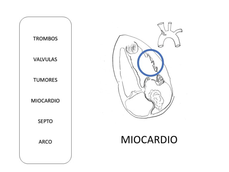 Diapositiva23