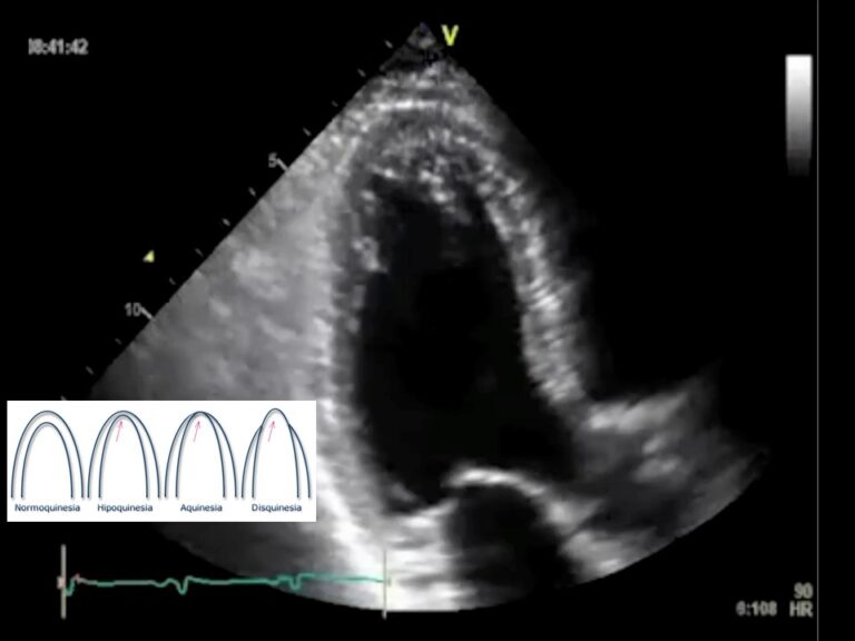 Diapositiva25