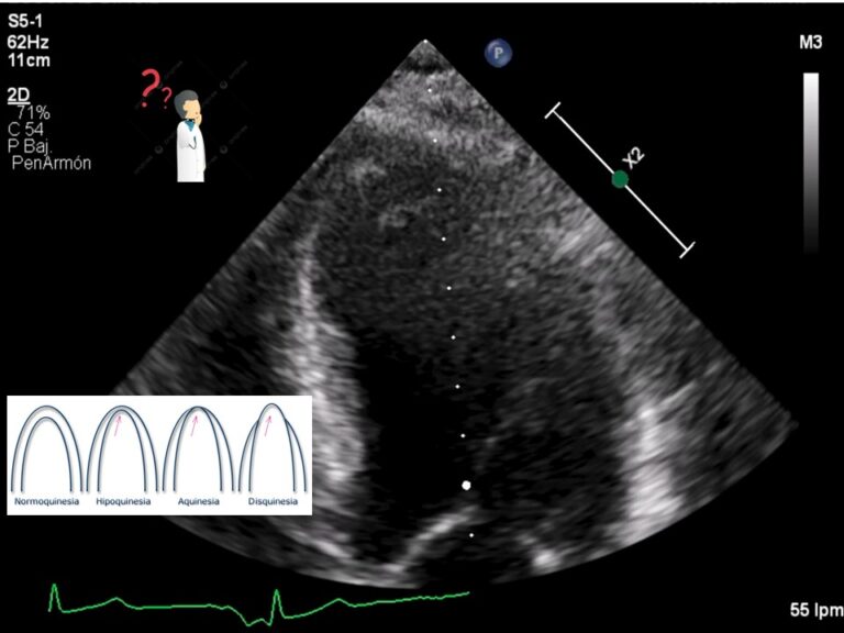 Diapositiva26