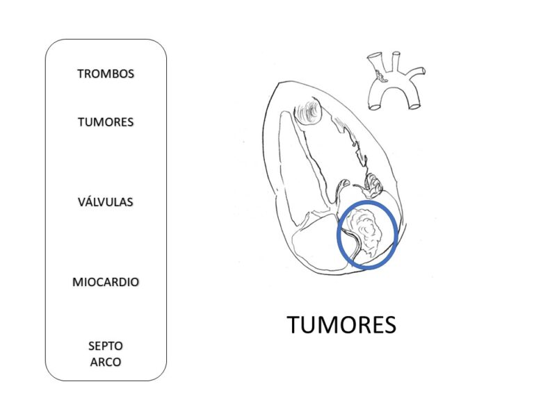 Diapositiva28