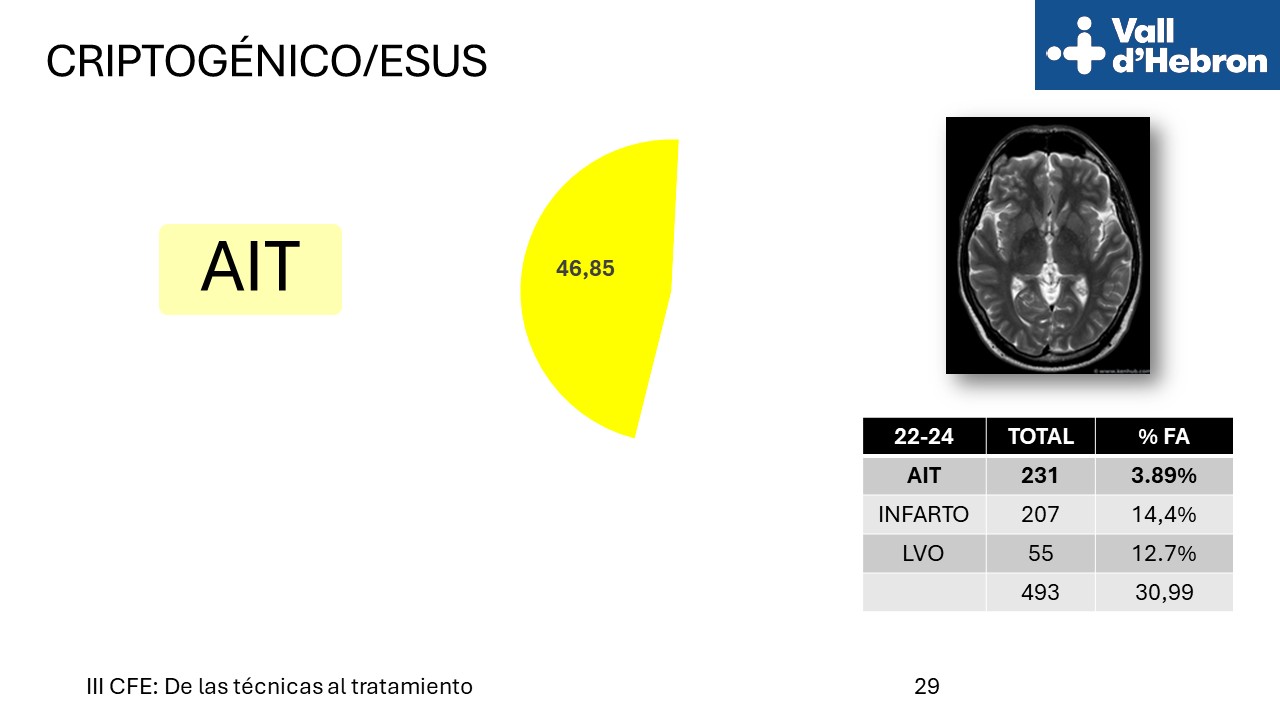 Diapositiva29