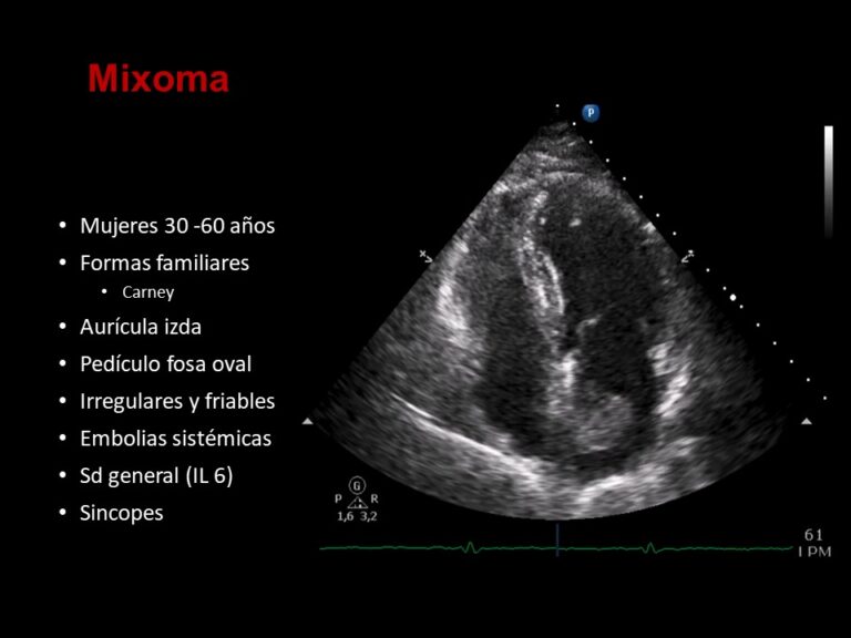 Diapositiva29