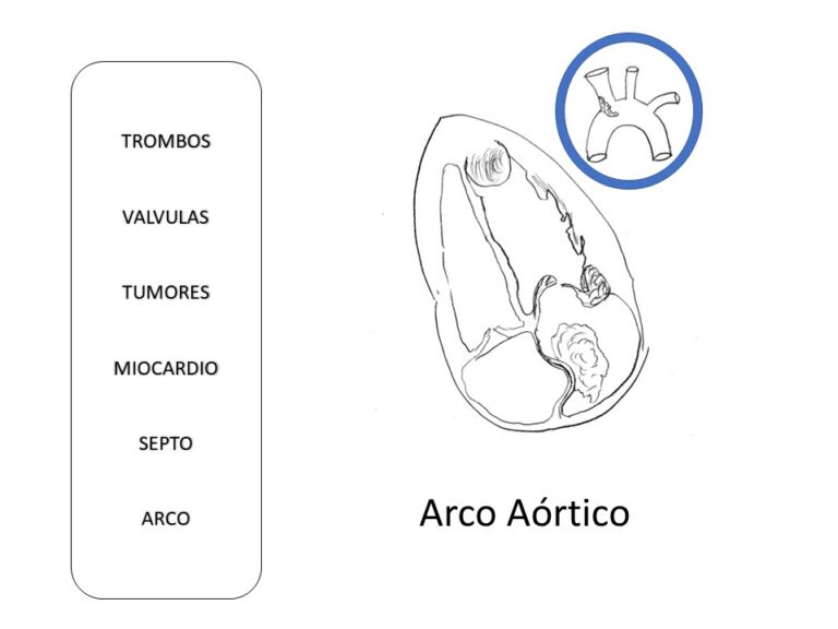 Diapositiva31