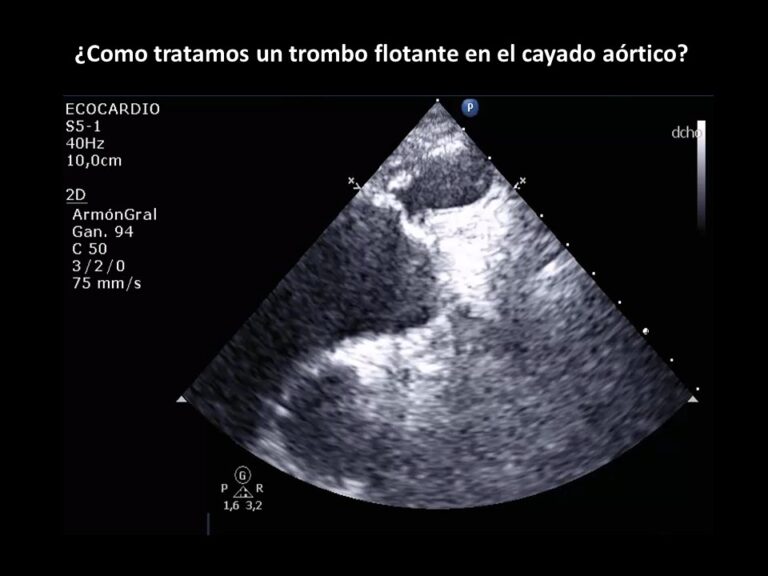 Diapositiva33
