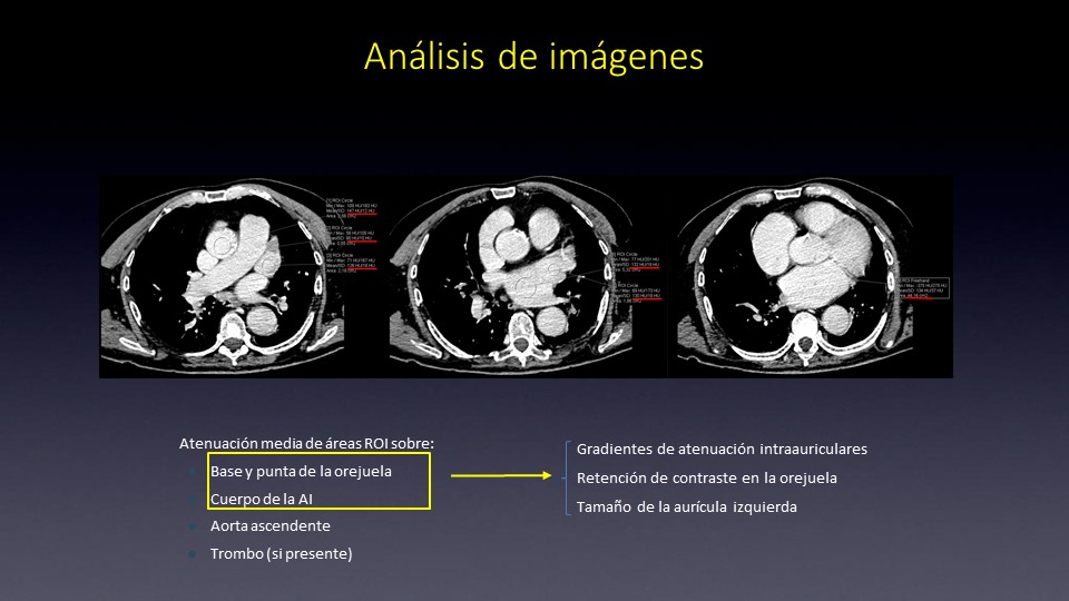 Diapositiva34