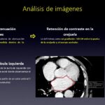 Diapositiva35
