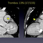 Diapositiva37
