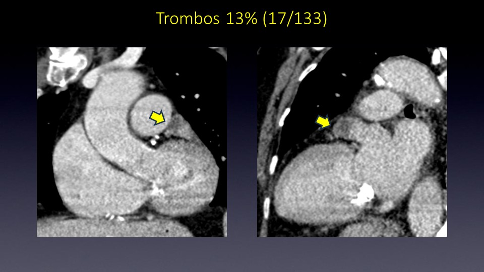 Diapositiva37