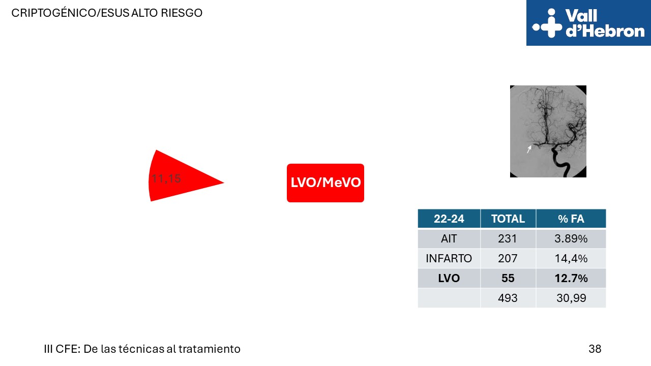 Diapositiva38