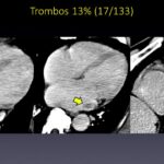Diapositiva38