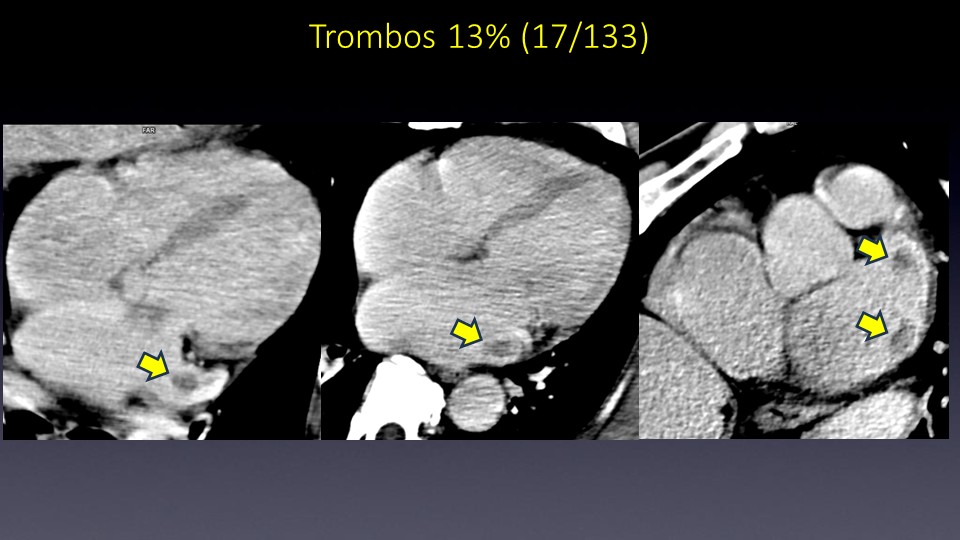 Diapositiva38