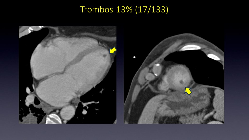 Diapositiva39