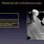 Diapositiva44