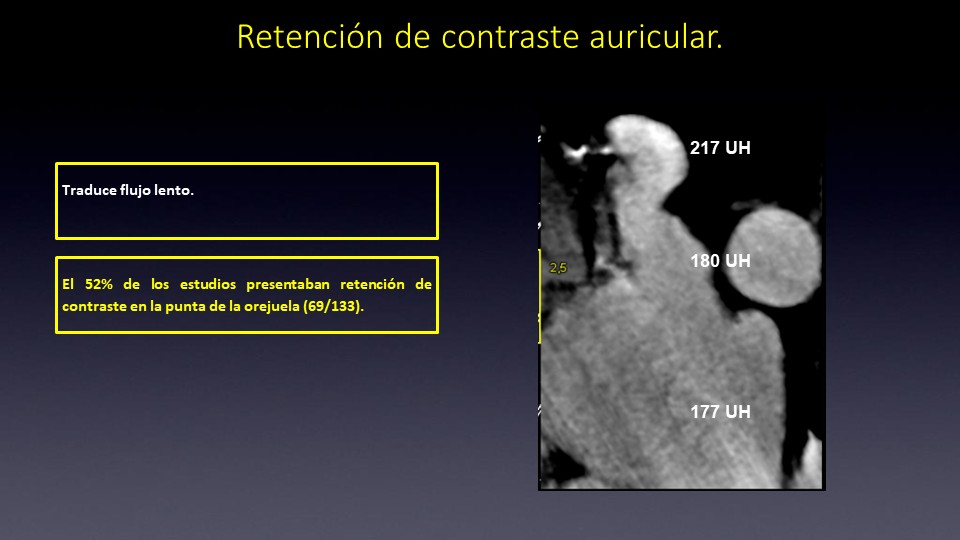 Diapositiva44