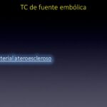 Diapositiva5