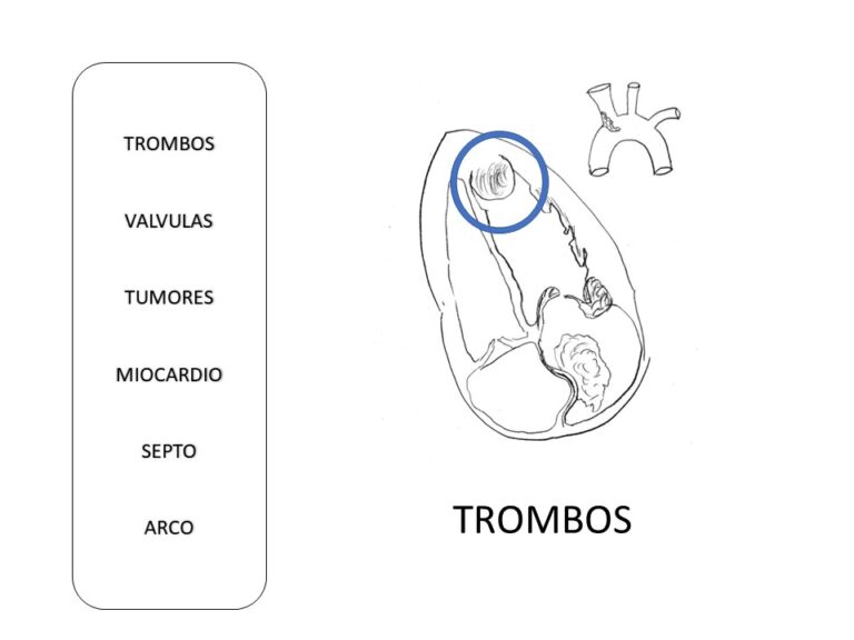 Diapositiva5