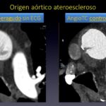 Diapositiva6