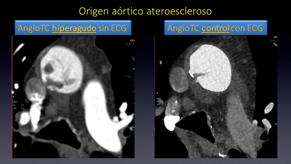 Diapositiva6