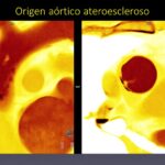 Diapositiva7