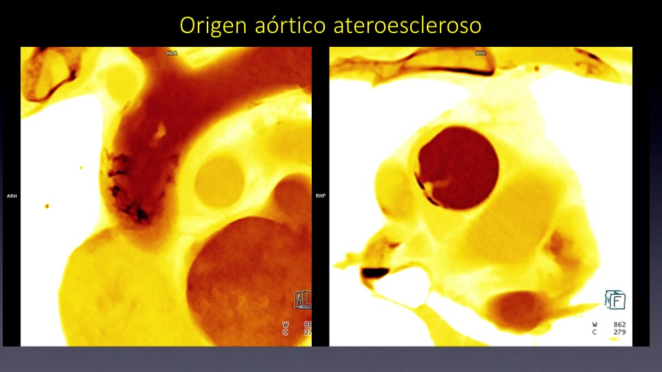 Diapositiva7