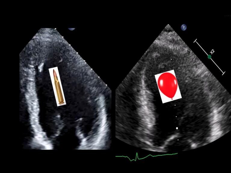 Diapositiva7